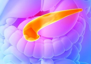 Пересадка поджелудочной железы - пример на фото 2